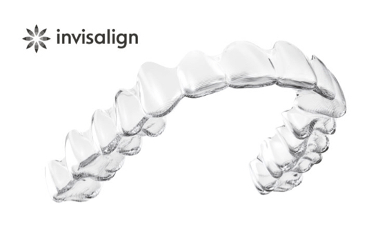 インビザライン invisalign