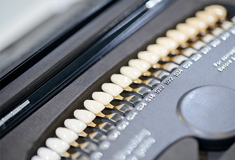 オフィスホワイトニング